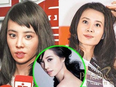 香港整容失败女星图片