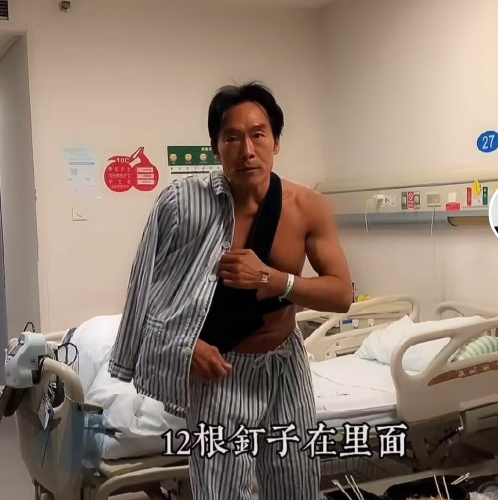 56岁郑浩南再拍古惑仔，戴红墨镜气势足，做完手术刚出院