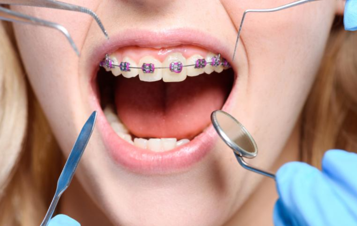 口腔医学技术是学什么的？