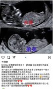 罗志祥43岁经纪人小霜宣布怀二胎 仍是试管婴儿孩子父亲不详